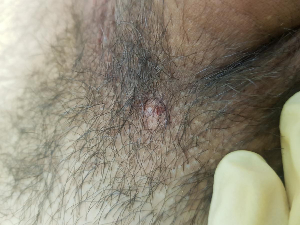 после удаления