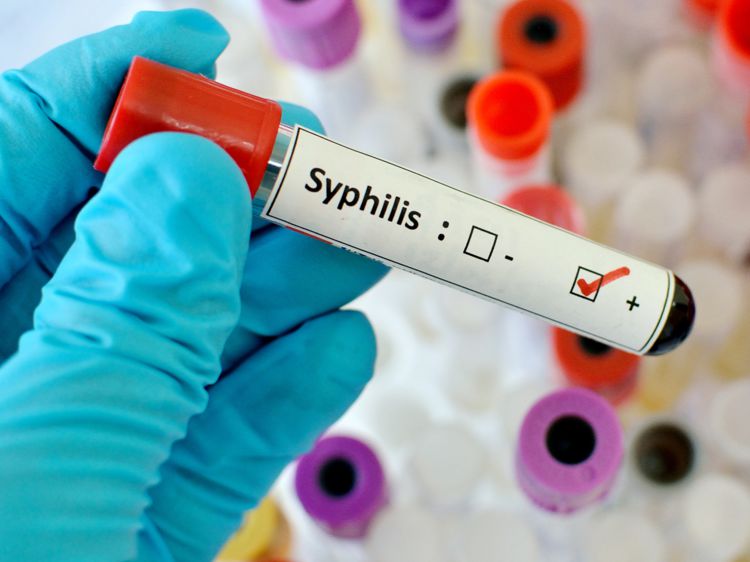 Анализ крови на сифилис: обнаружено