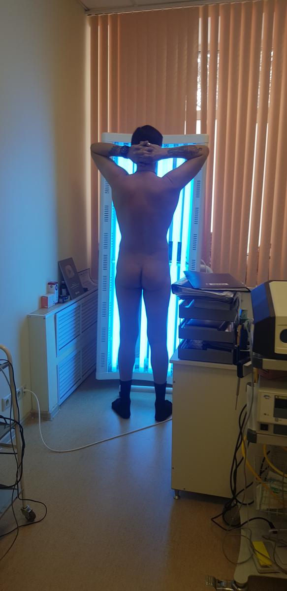 пува-терапия при кольцевидной эритеме Дарье пува-терапия