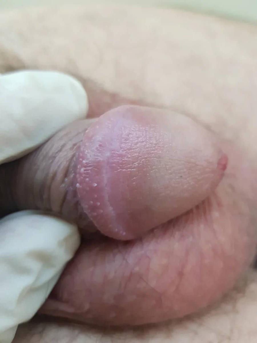 травма травма