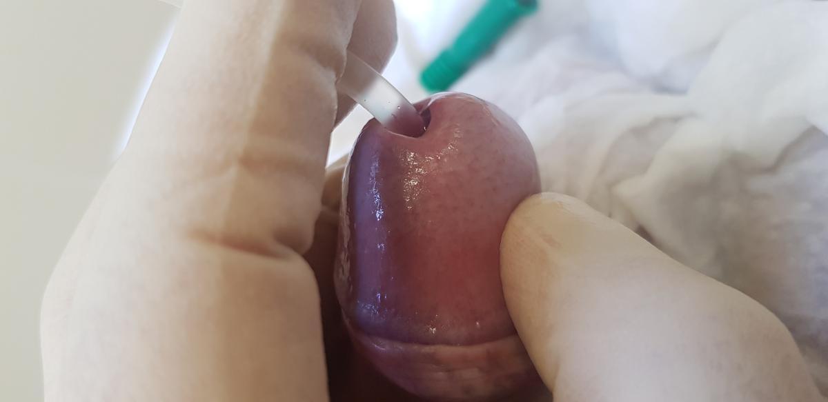 инстилляция