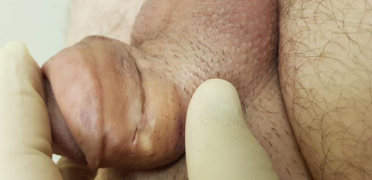 вазелин в половой член