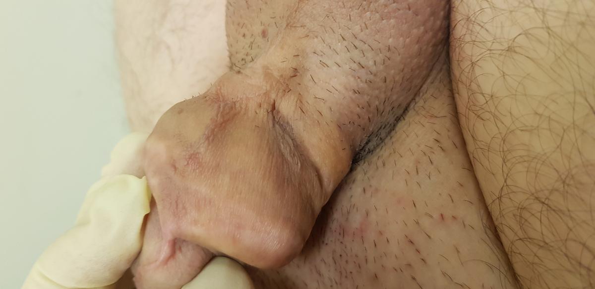 вазелин в члене