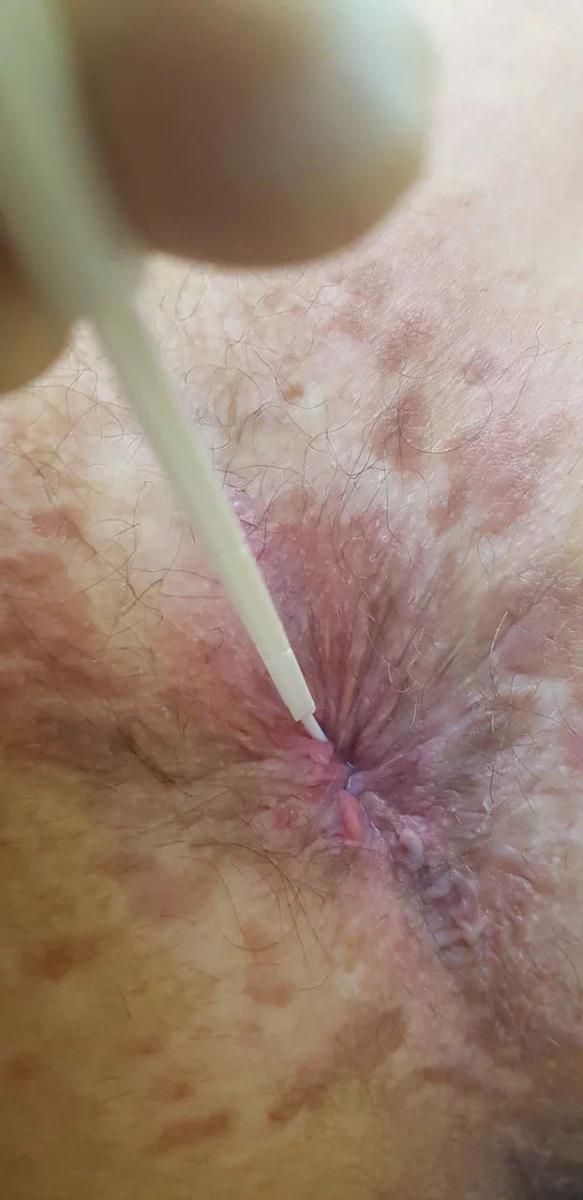 уф крови взятие мазка