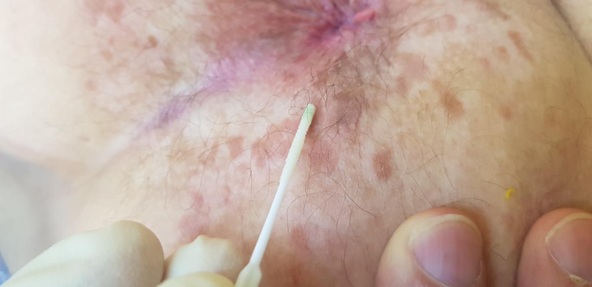 взятие мазка