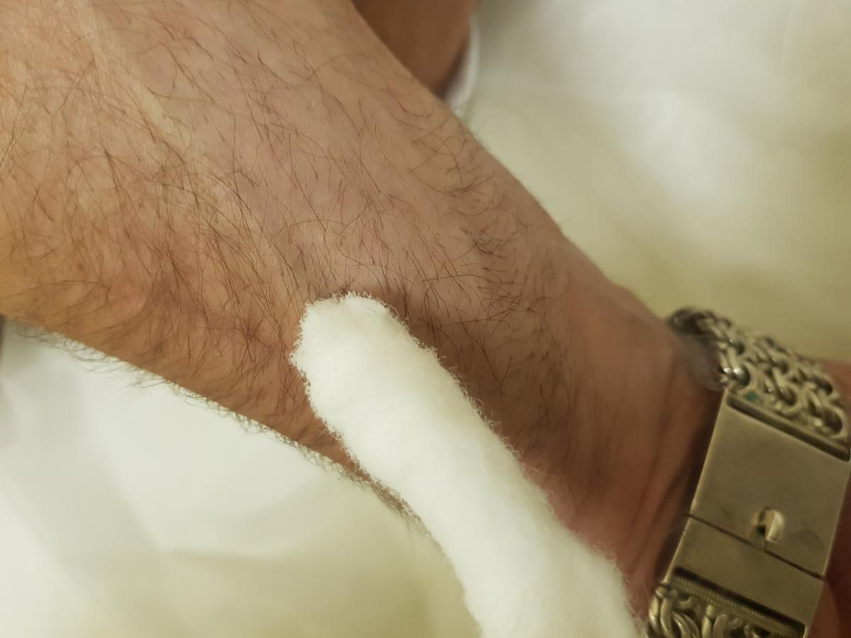 удаление азотом