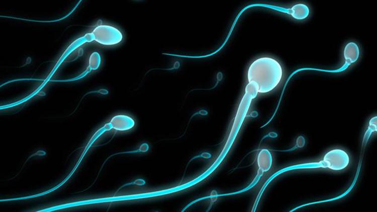 спермограмма при мужском бесплодии