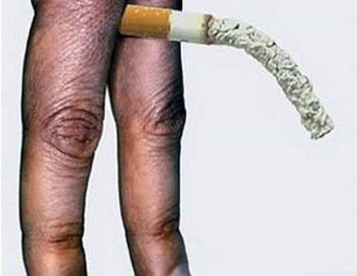 проблемы с эрекцией от курения