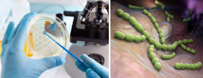 бактерии влагалищной микрофлоры в мазке у женщин