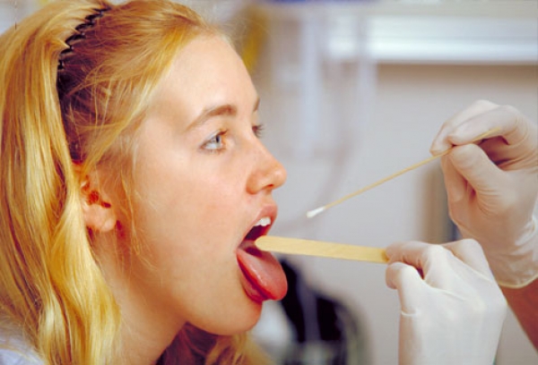 микоплазма гениталиум во рту у девушки