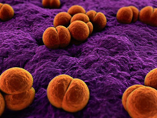 Возбудителем инфекционного процесса является специфическая бактерия гонококк