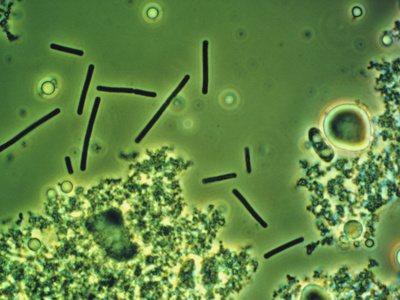 под микроскопом определяются лактобациллы, небольшое количество клеток плоского эпителия и единичные лейкоциты