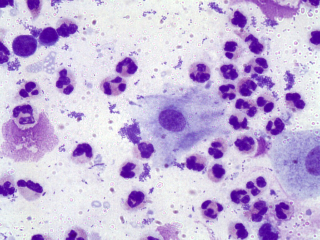 Лейкоциты в микроскопии мазка