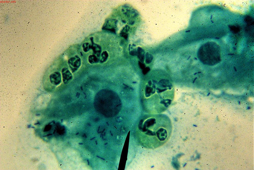 Микоплазма под микроскопом в мазке