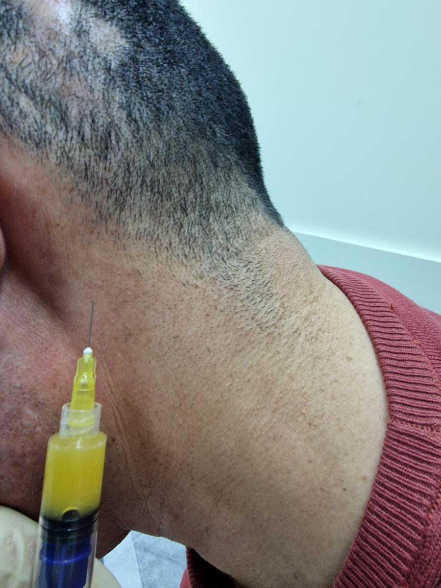 лечение при повышенных антителах к сифилису антитела к бледной трепонеме в крови человека