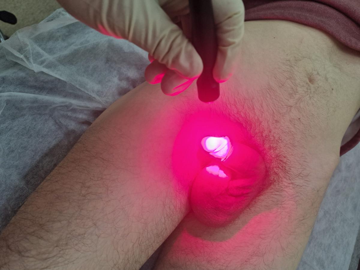 фотодинамическая терапия фтд