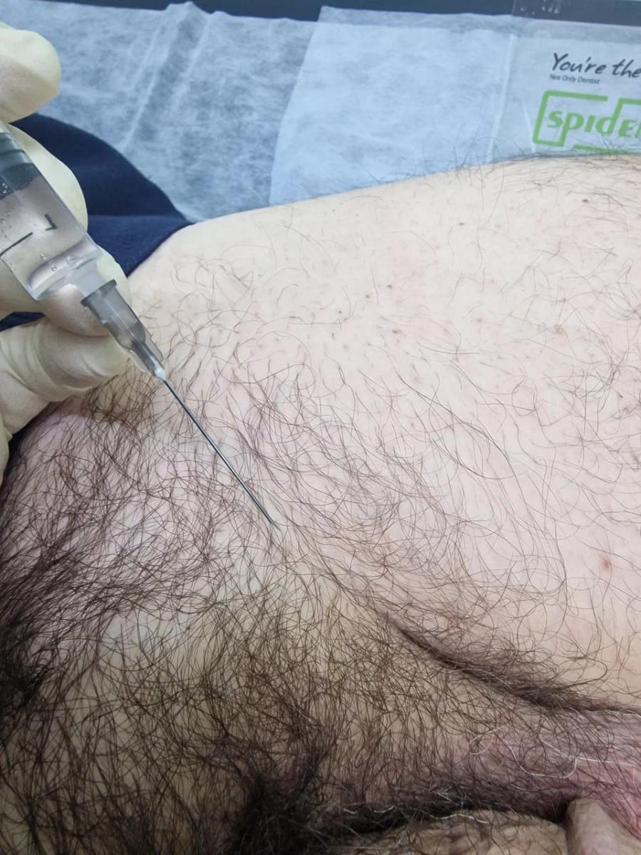 Лимфотропное введение Лимфотропное введение
