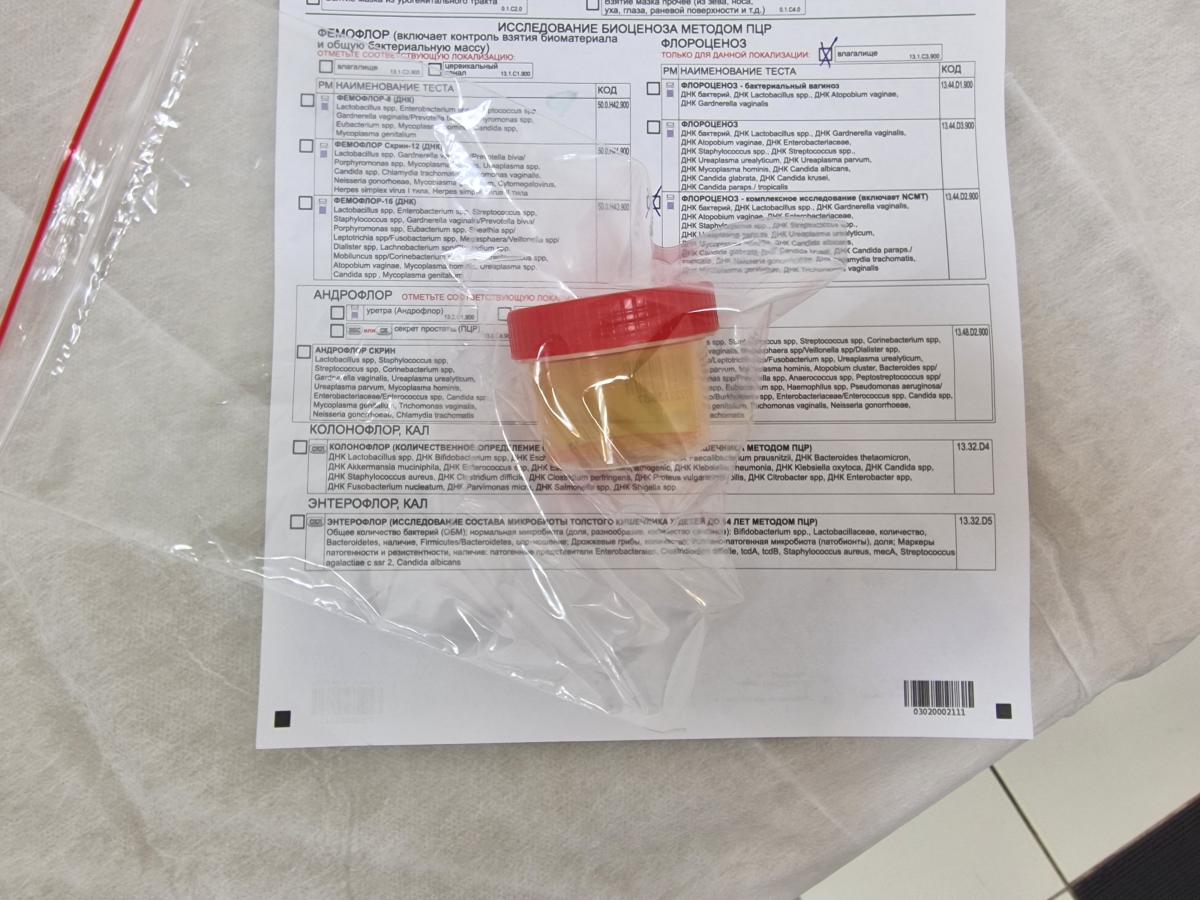 Пробирка с анализами на ИППП