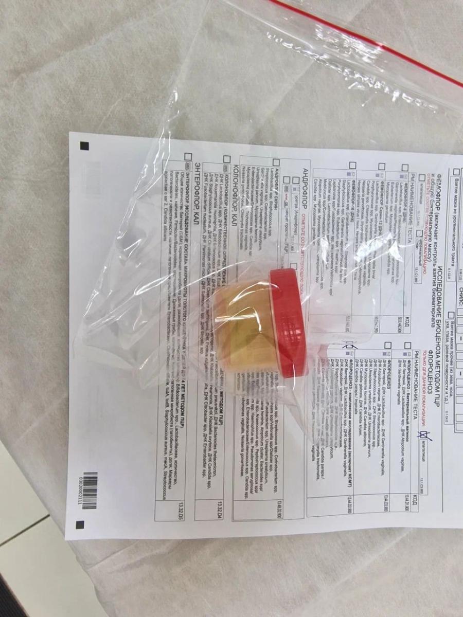 анализ мочи