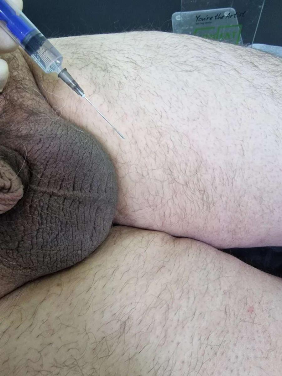 Лимфотропное введение
