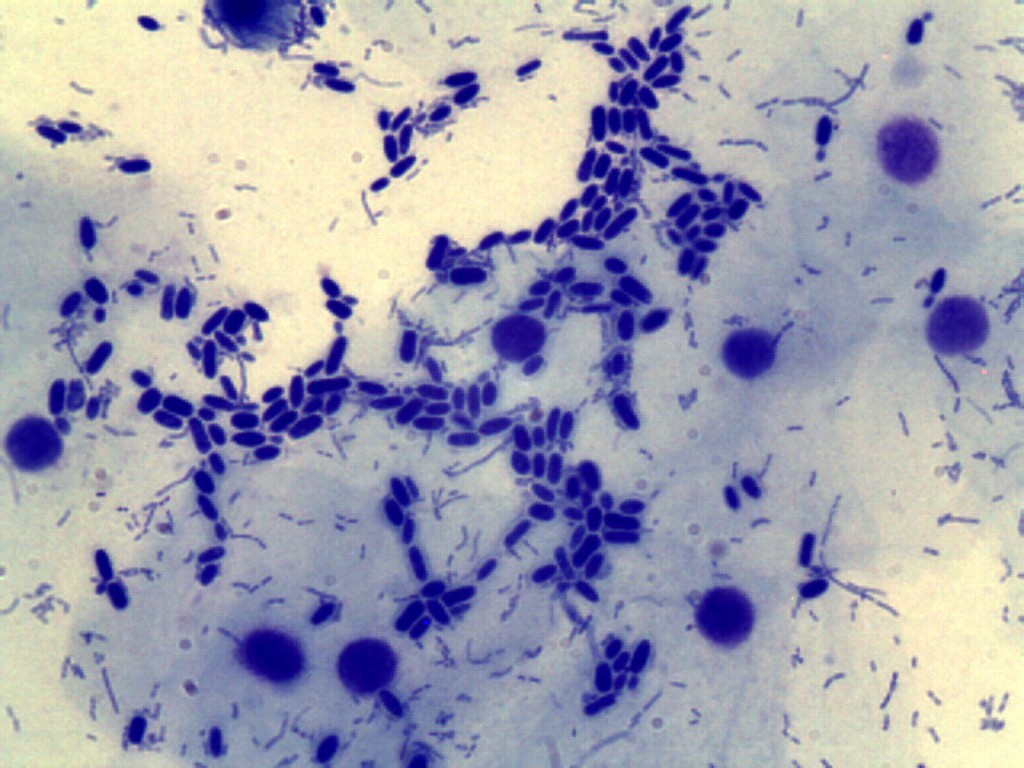 Дрожжевые грибки в мазке под микроскопом
