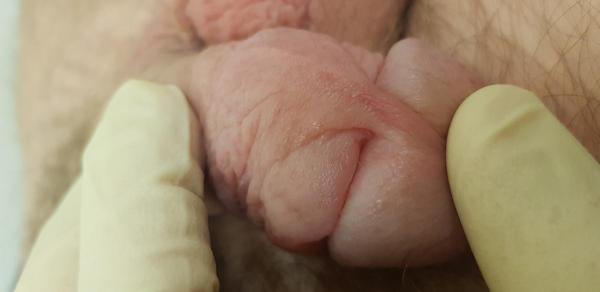 натертость