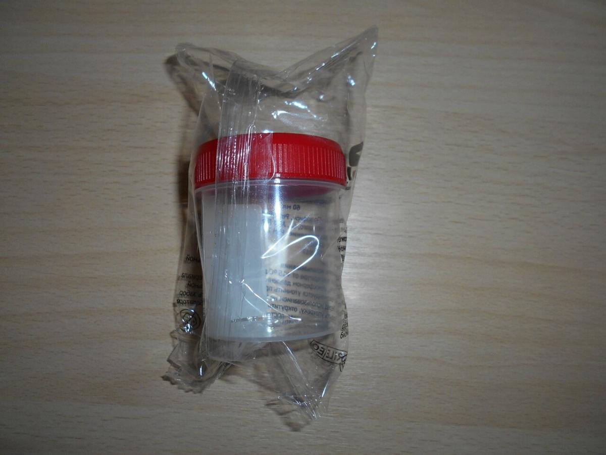 исследование мочи