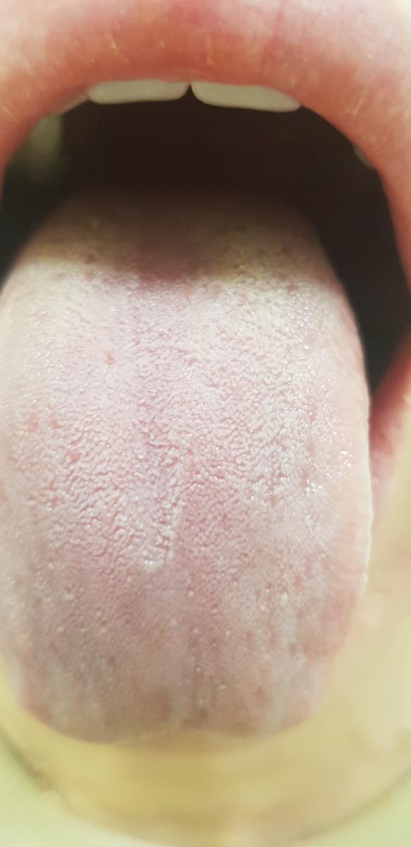 после лечения после