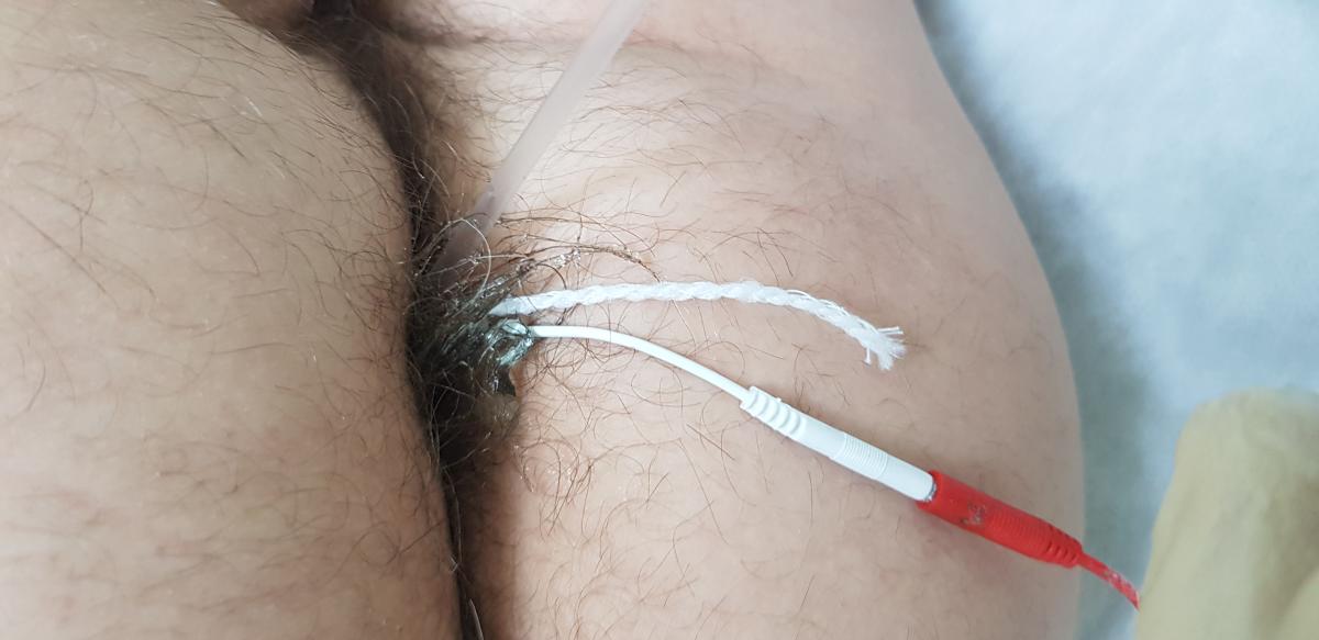 электрофорез