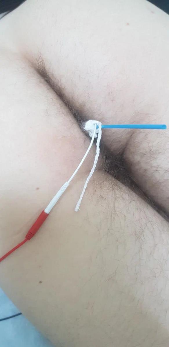 Электрофорез лекарственных препаратов