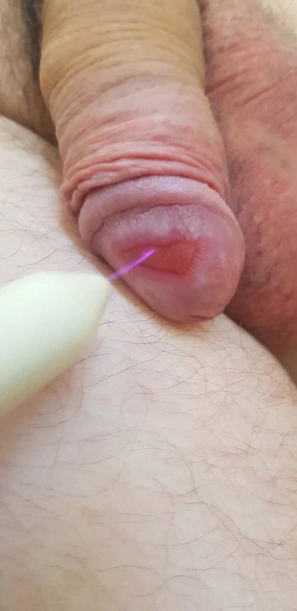 Аппарат гелиевой плазмы