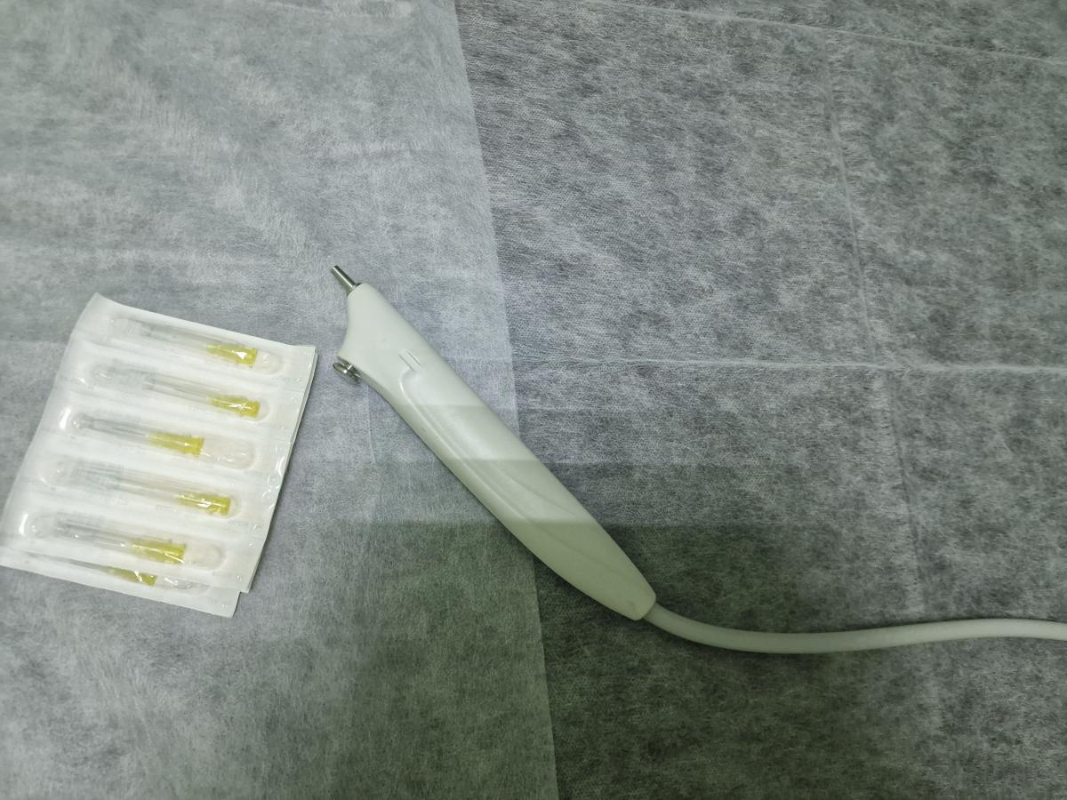 карбокситерапия