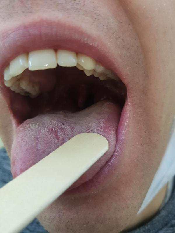  можно ли заразиться уреаплазмой через рот