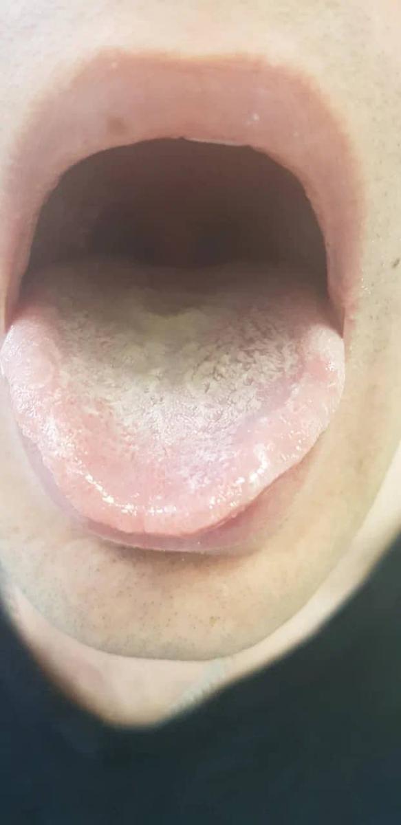 белый язык белый язык