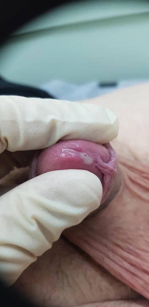  болезнетворные микроорганизмы