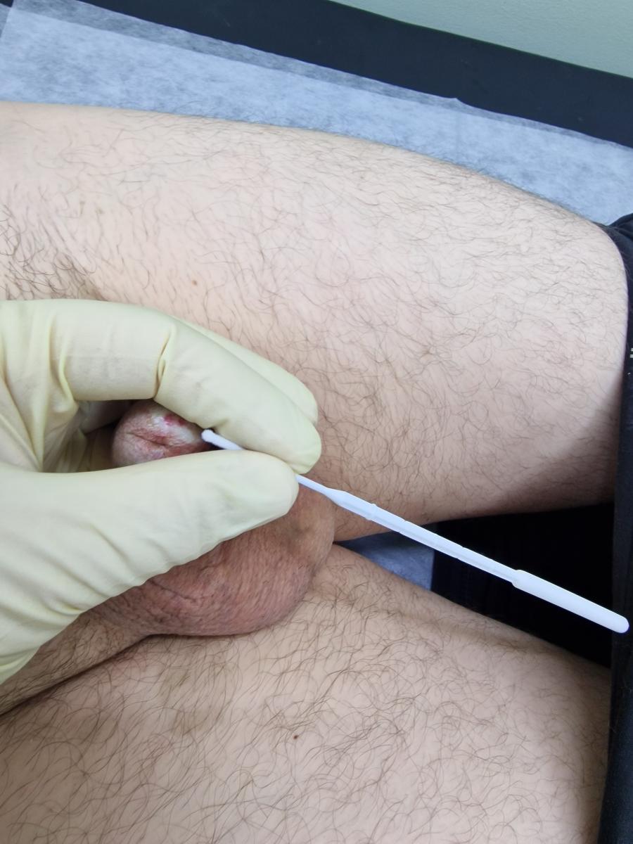 Мазки на инфекции из уретры Мазки на инфекции