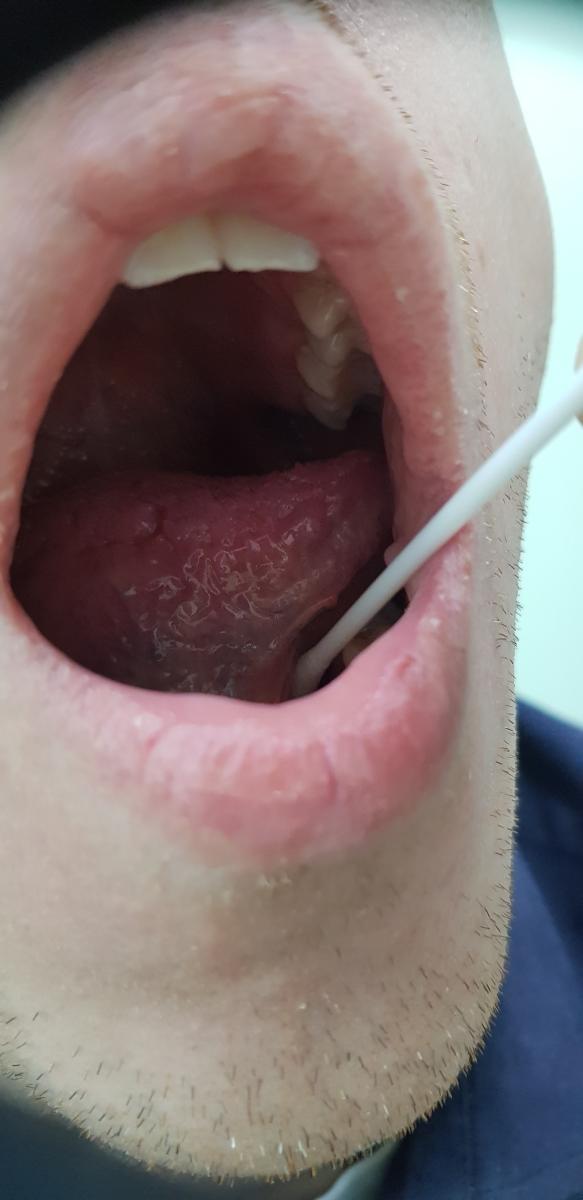 Мазки из уретры, простаты, рта, ануса2