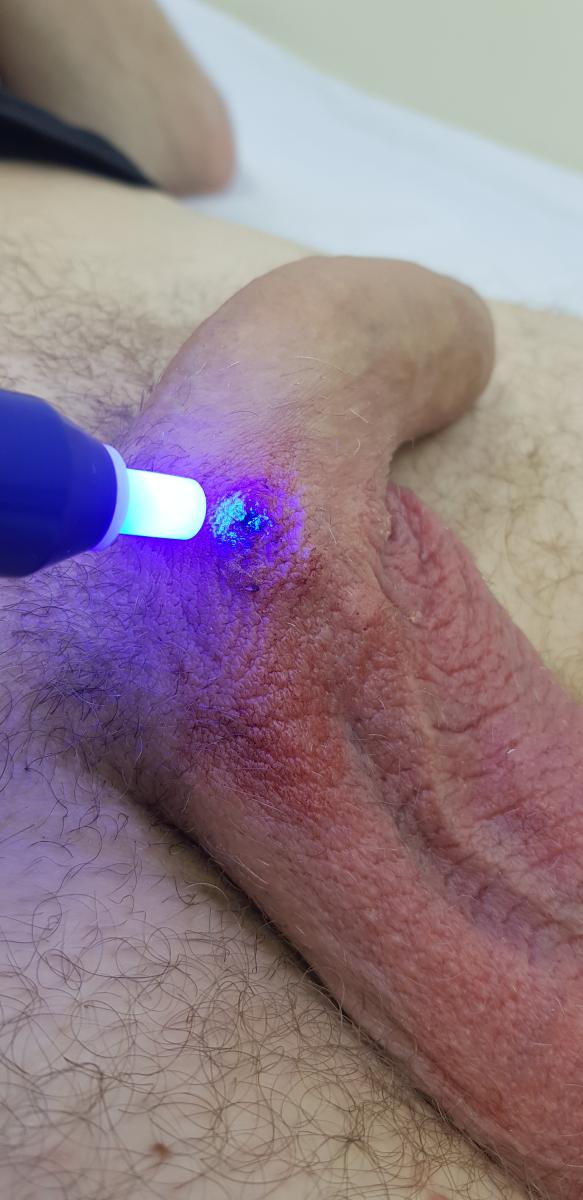  оксид азота