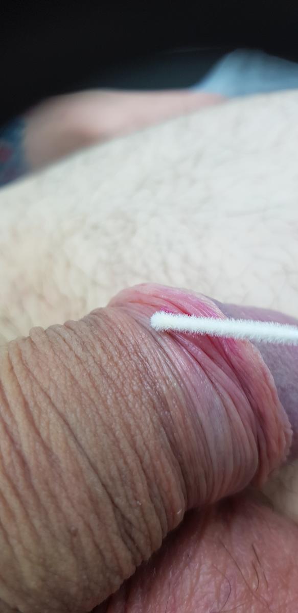 Анализы ПЦР в лаборатории