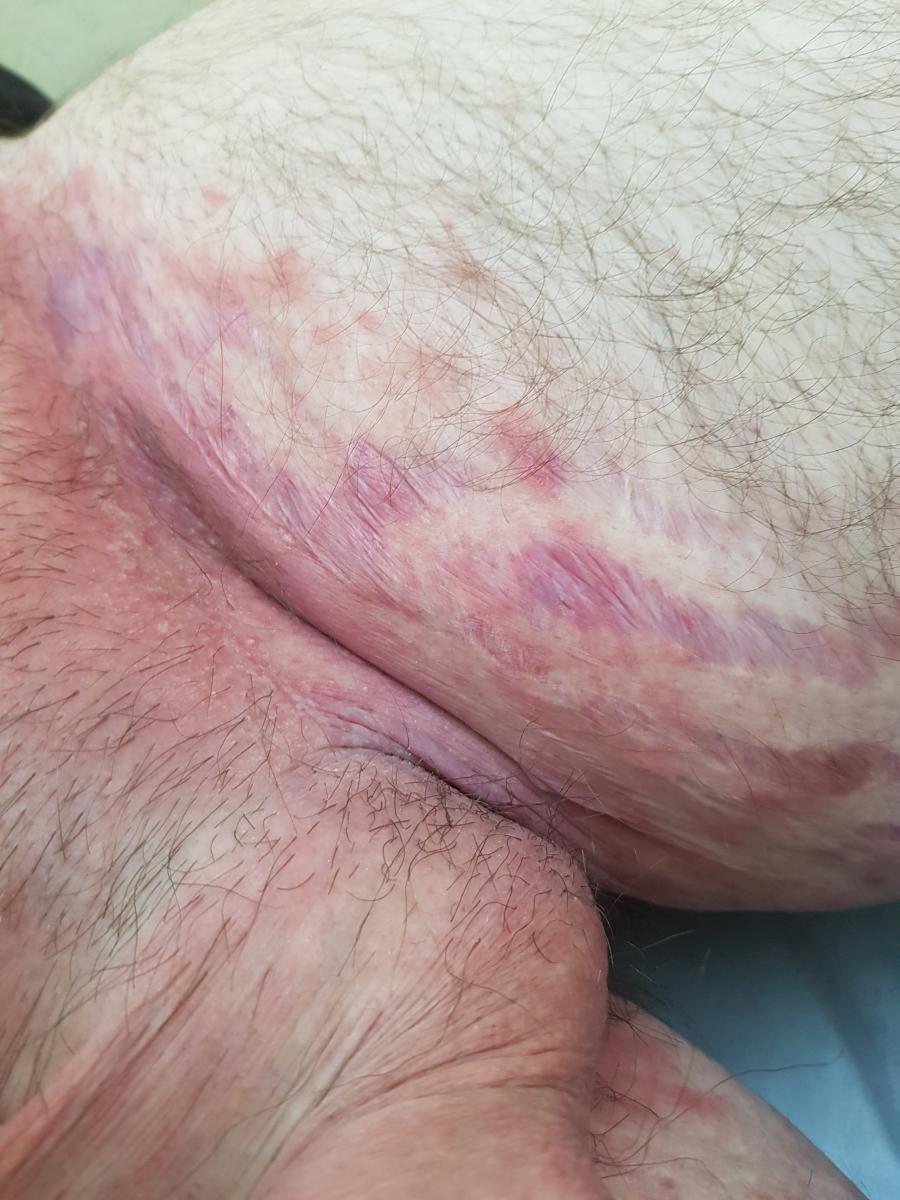 Красные пятна