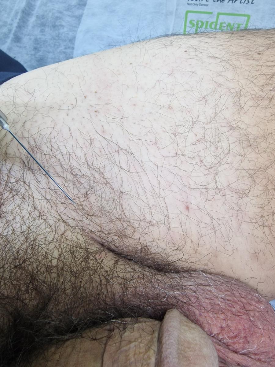 Лимфотропное
