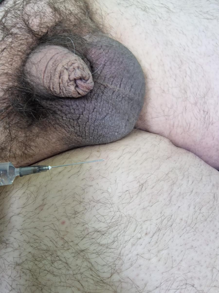 лимфотропное лечение