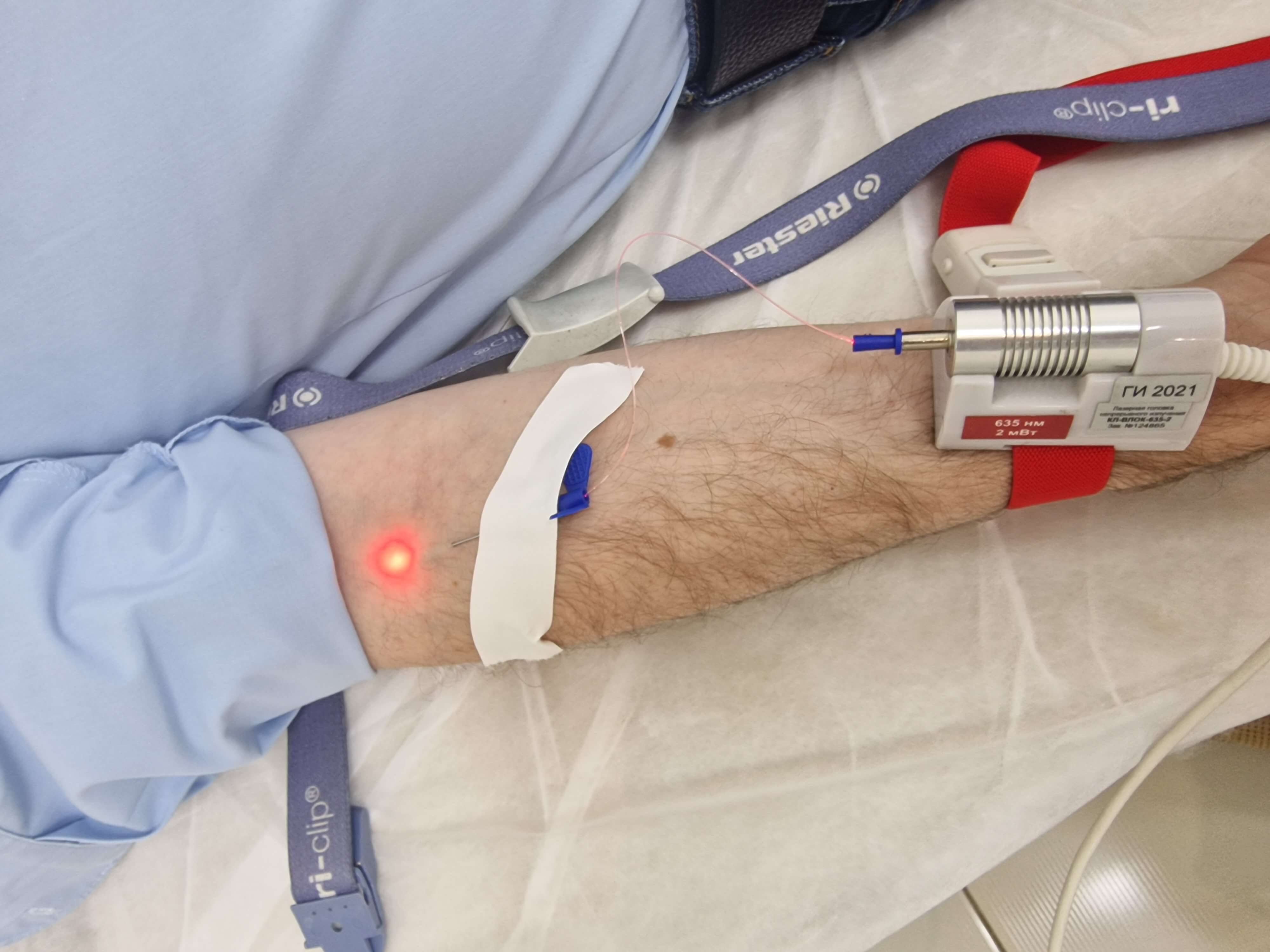 лазерное облучение крови
