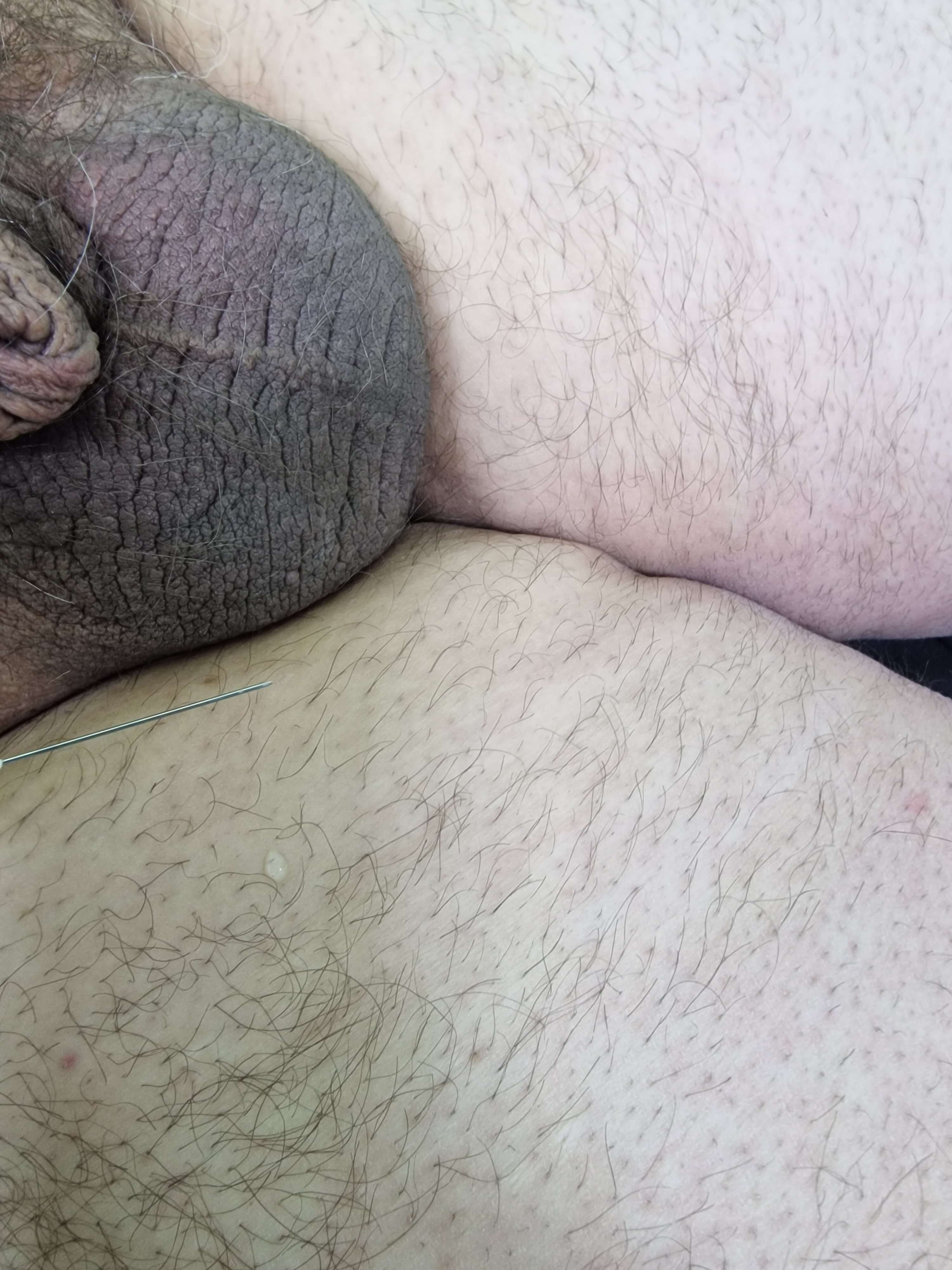 введение антибиотиков