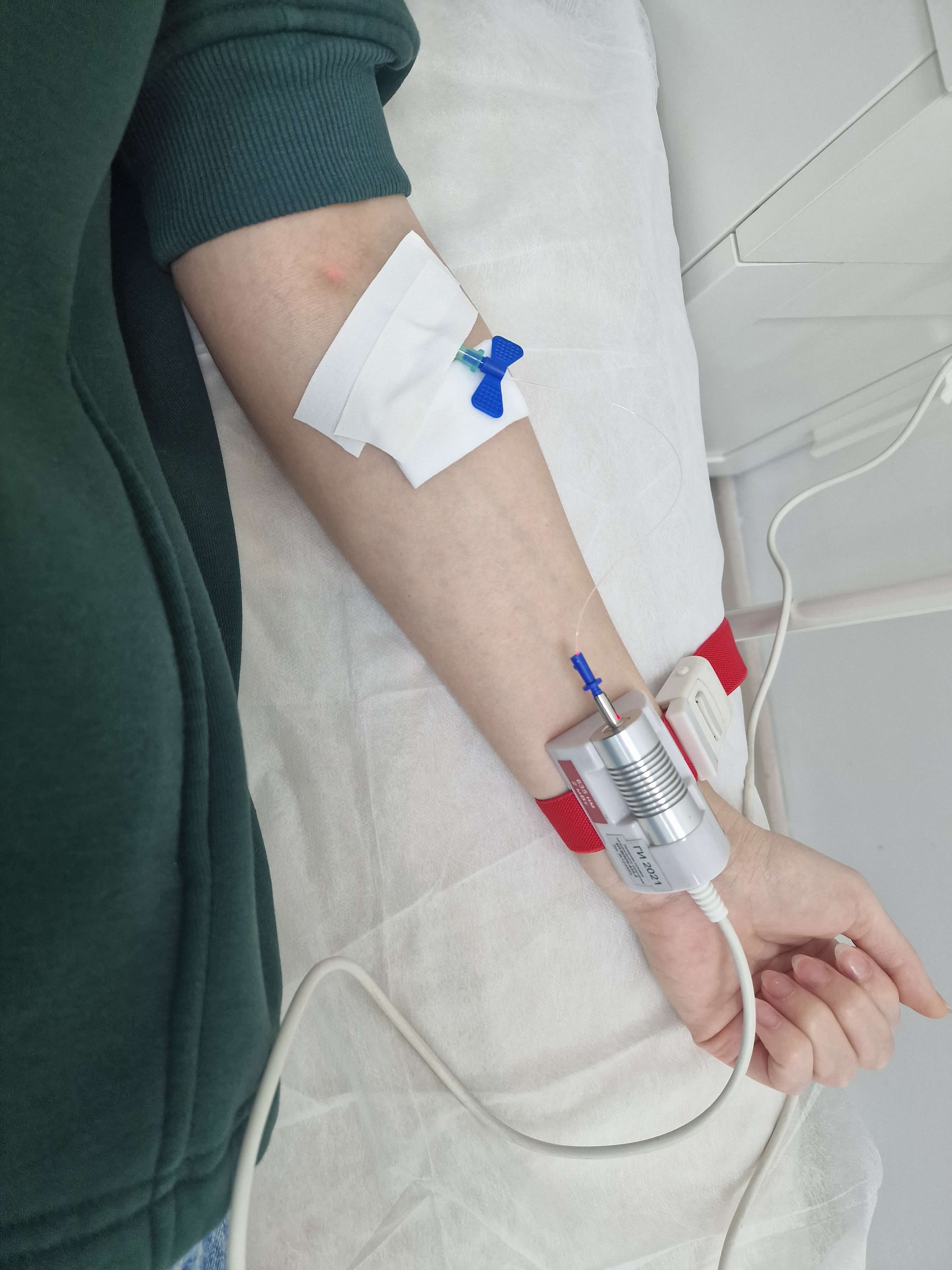 Внутривенное облучение крови