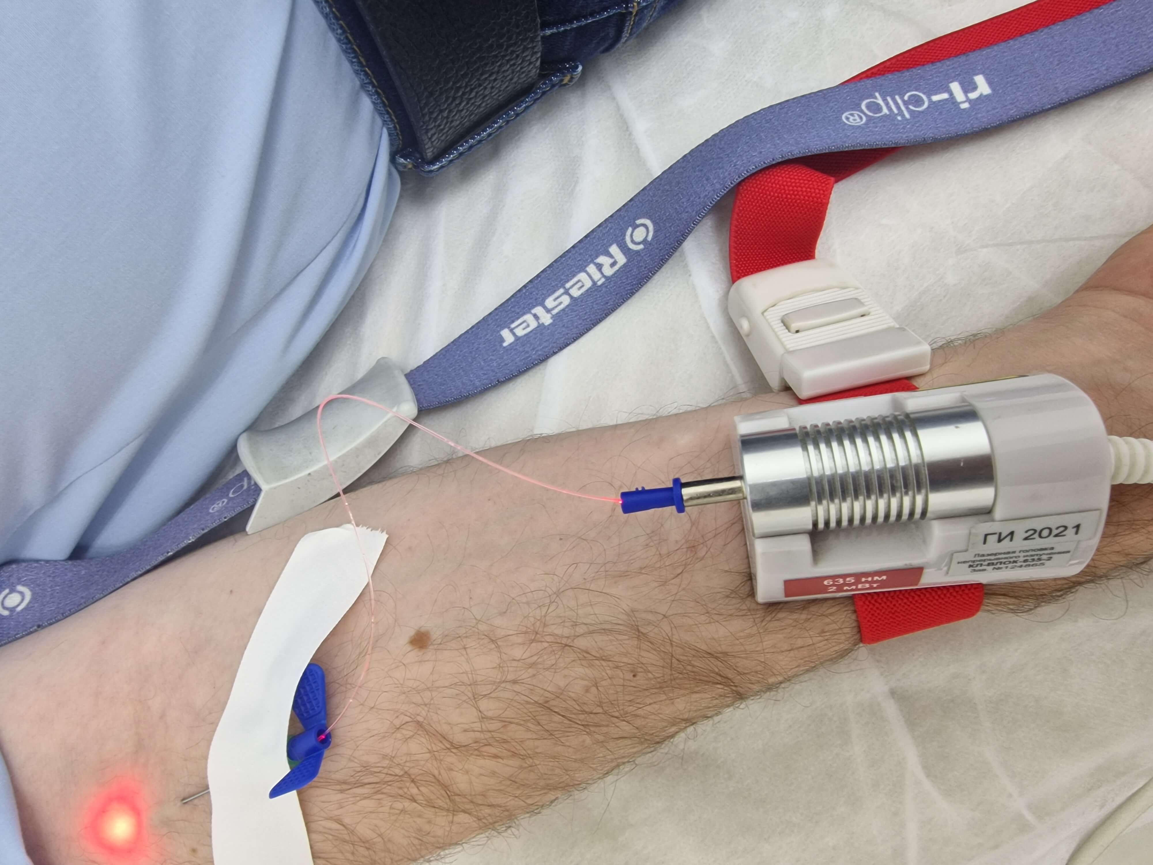 лазерное облучение крови