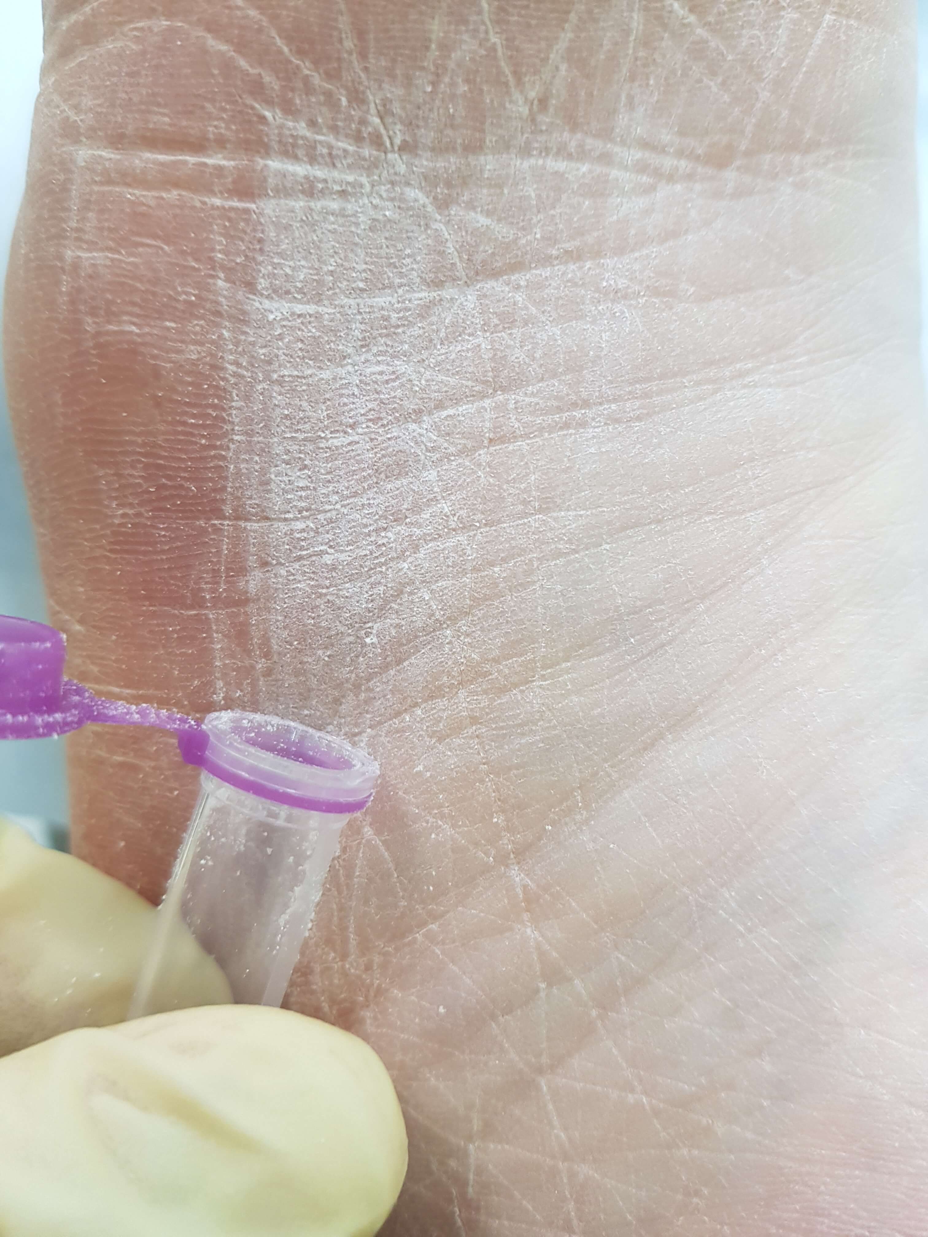 сбор фрагментов мицелия