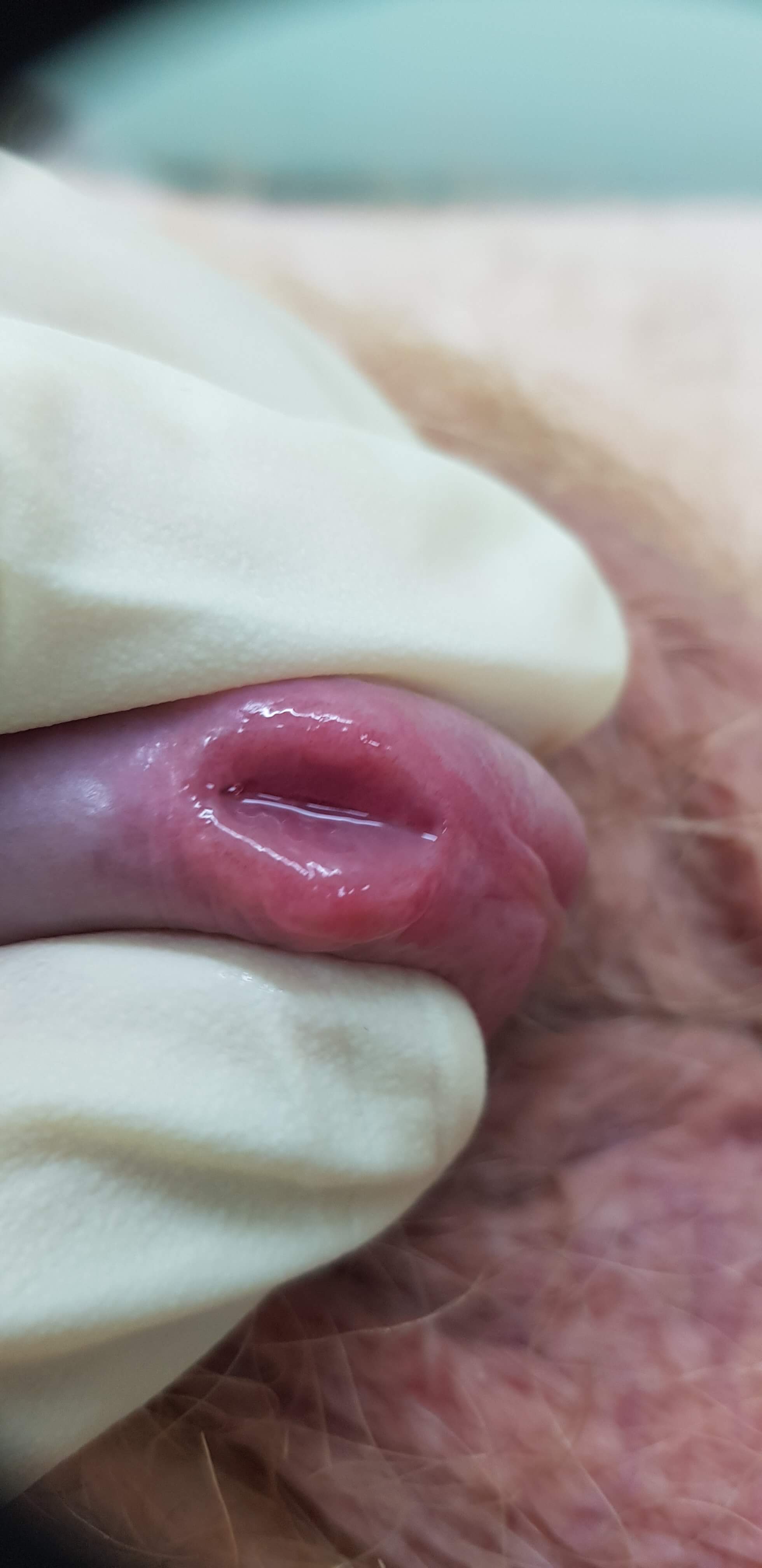 инфекции репродуктивной системы