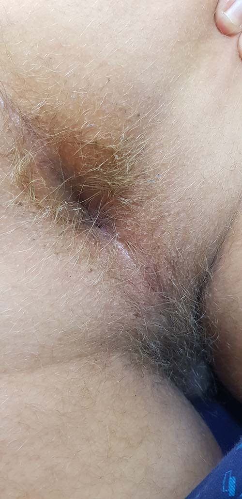 гигиена мальчиков гигиена подростков