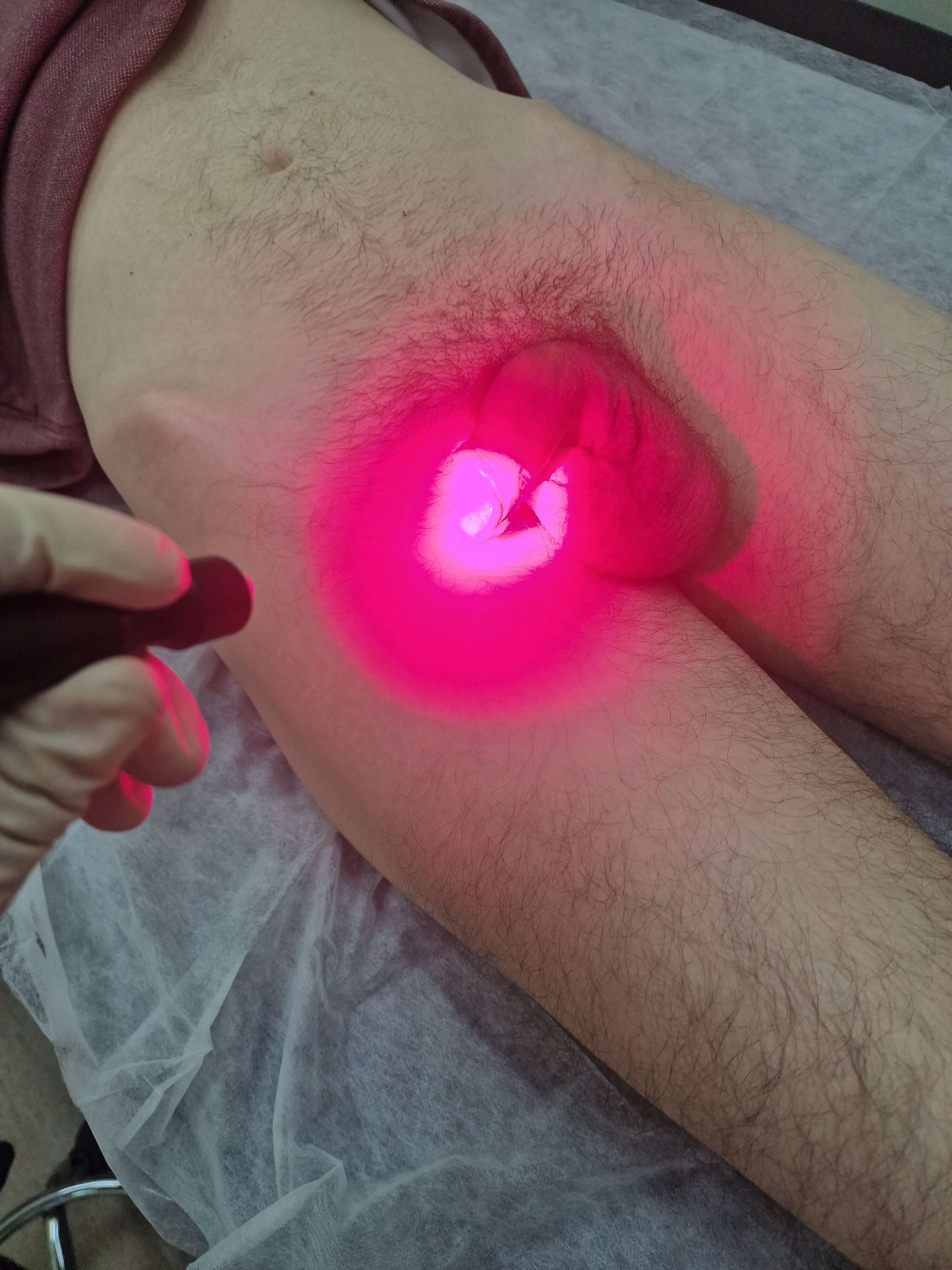 Лазерная фотодинамическая терапия